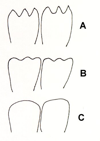 drawing-saw-teeth.jpg